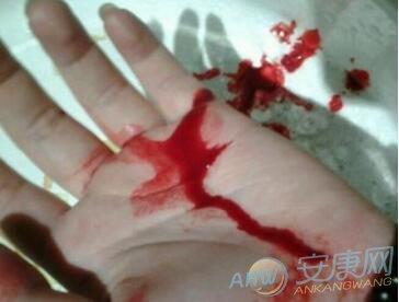 描写重伤满身血的句子