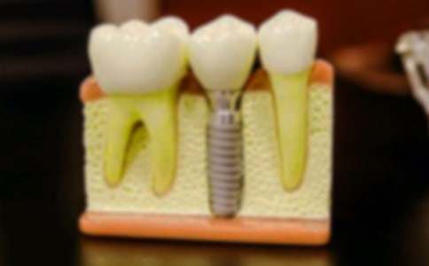 拔牙记作文精华[15篇]