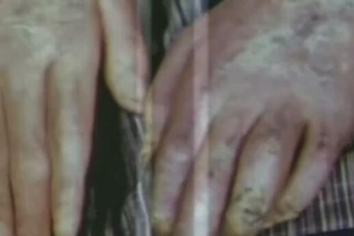 福岛核泄漏后变异女人什么样子