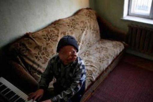 福岛核泄漏后变异女人什么样子