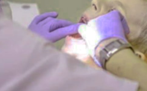 拔牙记小学写事作文400字