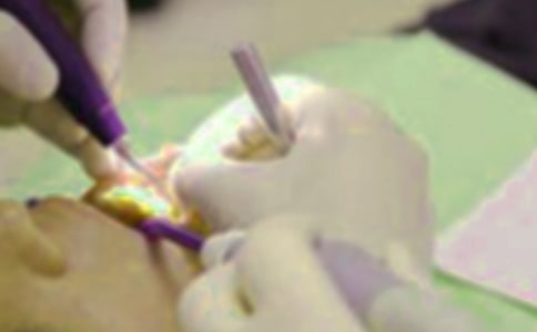 拔牙记初一优秀作文