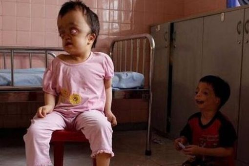 福岛核泄漏后变异女人什么样子